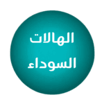 للهالات السوداء
